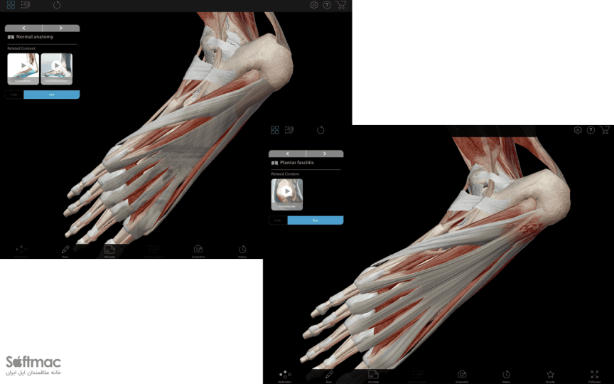 اسکرینشات 1 Visible Body Muscle Premium